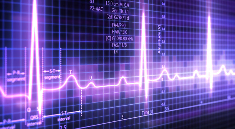7fc3c26ac7a6fa24d67b9791ea6f41c5.jpg pulse monitor screen