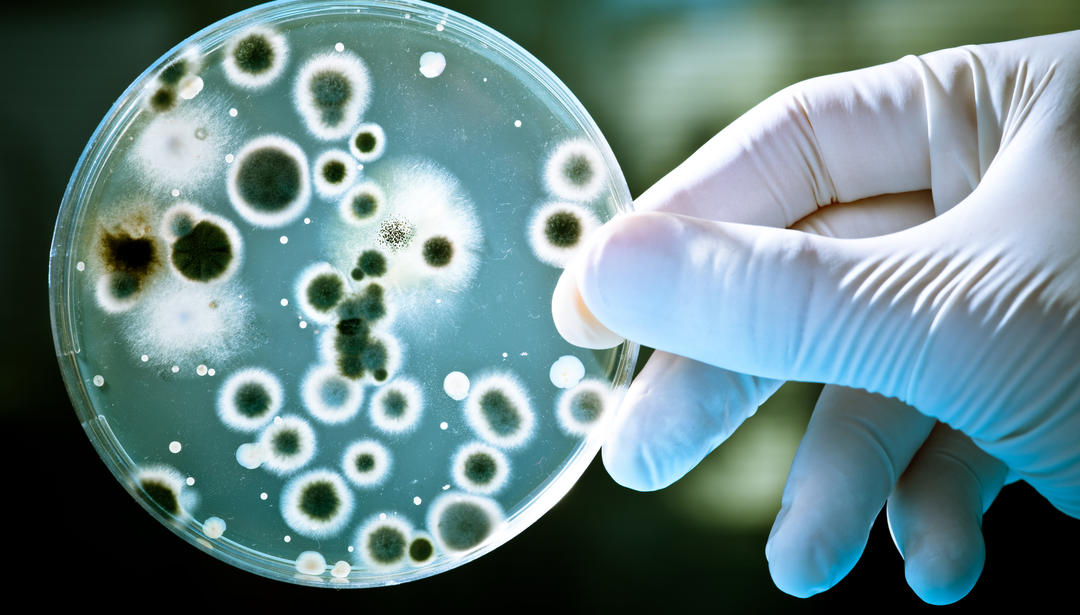 Hand with glove holding petri dish with cells shown