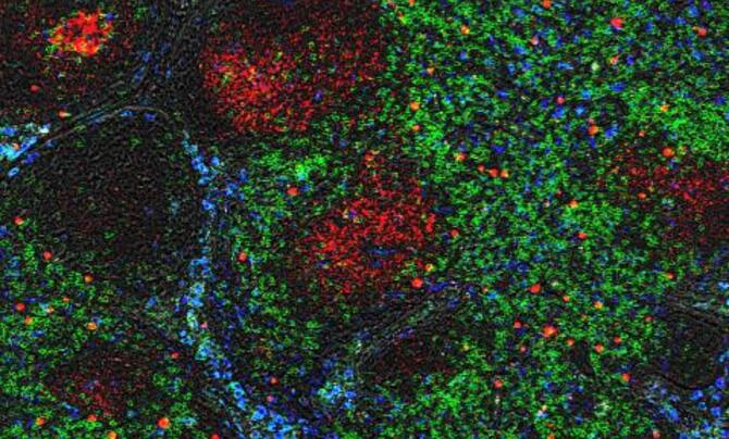 Lymph node RNAscope showing SIV-infected cells