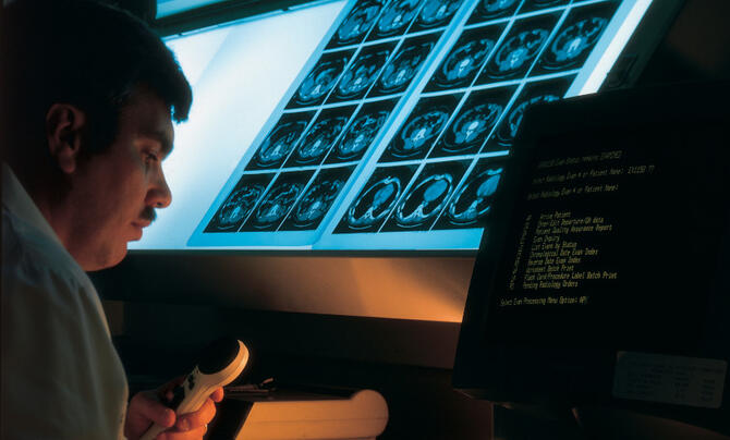 Doctor looking at brain scans on a screen