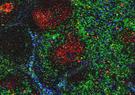 Lymph node RNAscope showing SIV-infected cells